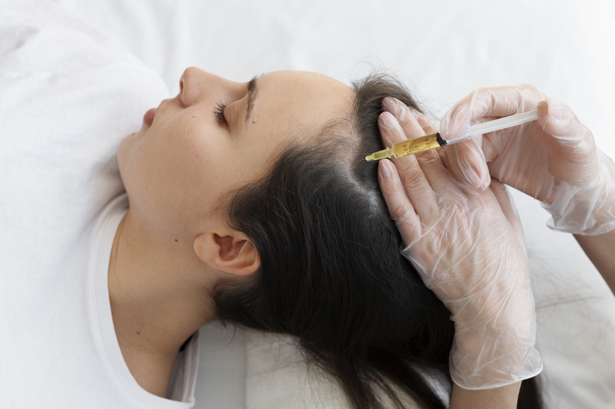 PRP hair loss Skin Tone Clinic regeneration